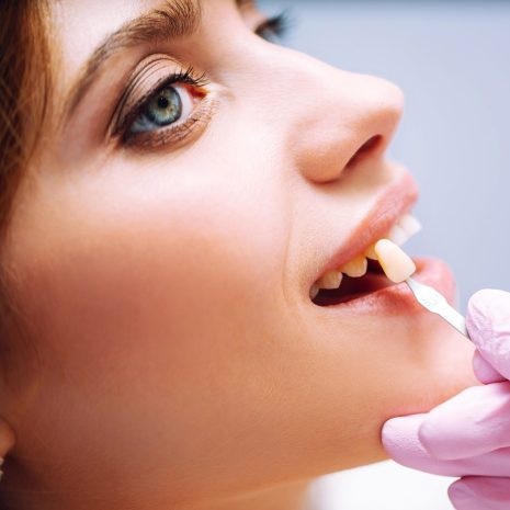 لمینیت و کامپوزیت