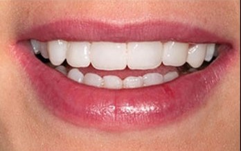 portfolio slider image